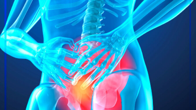 respuesta de grado 3 de cáncer de próstata
