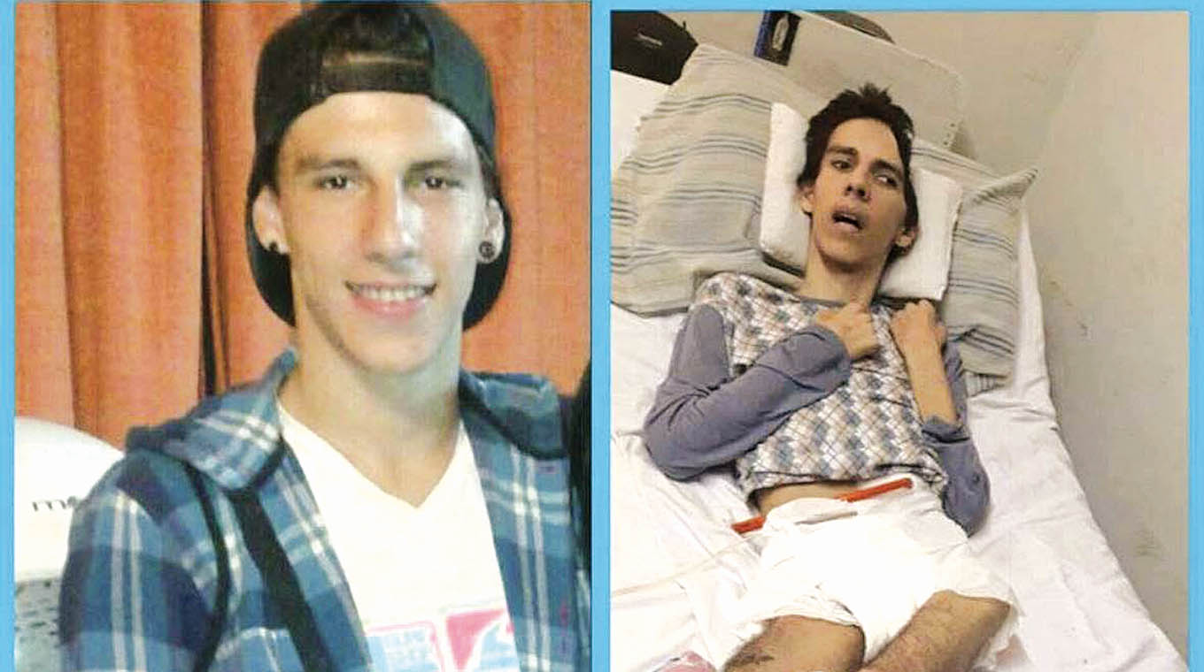 Falleció Leandro Ribeiro, joven que quedó cuadripléjico tras un siniestro de tránsito